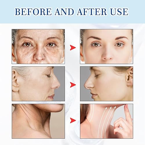 Miniatura 5 de Suero de ácido hialurónico para piel 100% puro suero antienvejecimiento hidratación intensa humedad no graso sin parabenos suero reductor e