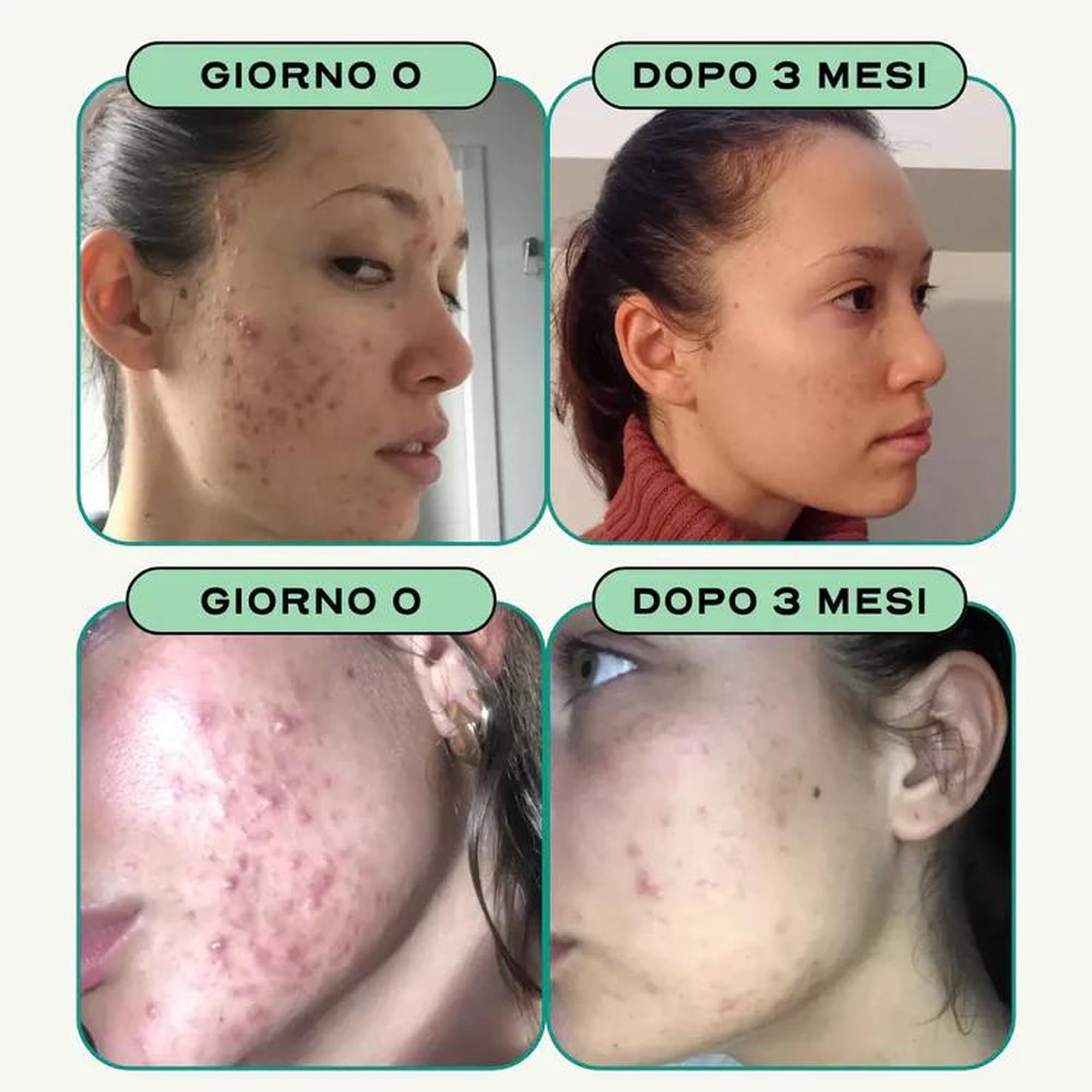 Circles CLEAR + BALANCE Duo Donna - Acne Ormonale & Equilibrio Ormonale - Zinco + Magnesio Bisglicinato + Agnocasto Bardana Rodiola - Post-Pillola SPM Ciclo Femminile - 120 Capsule Vegan Francia