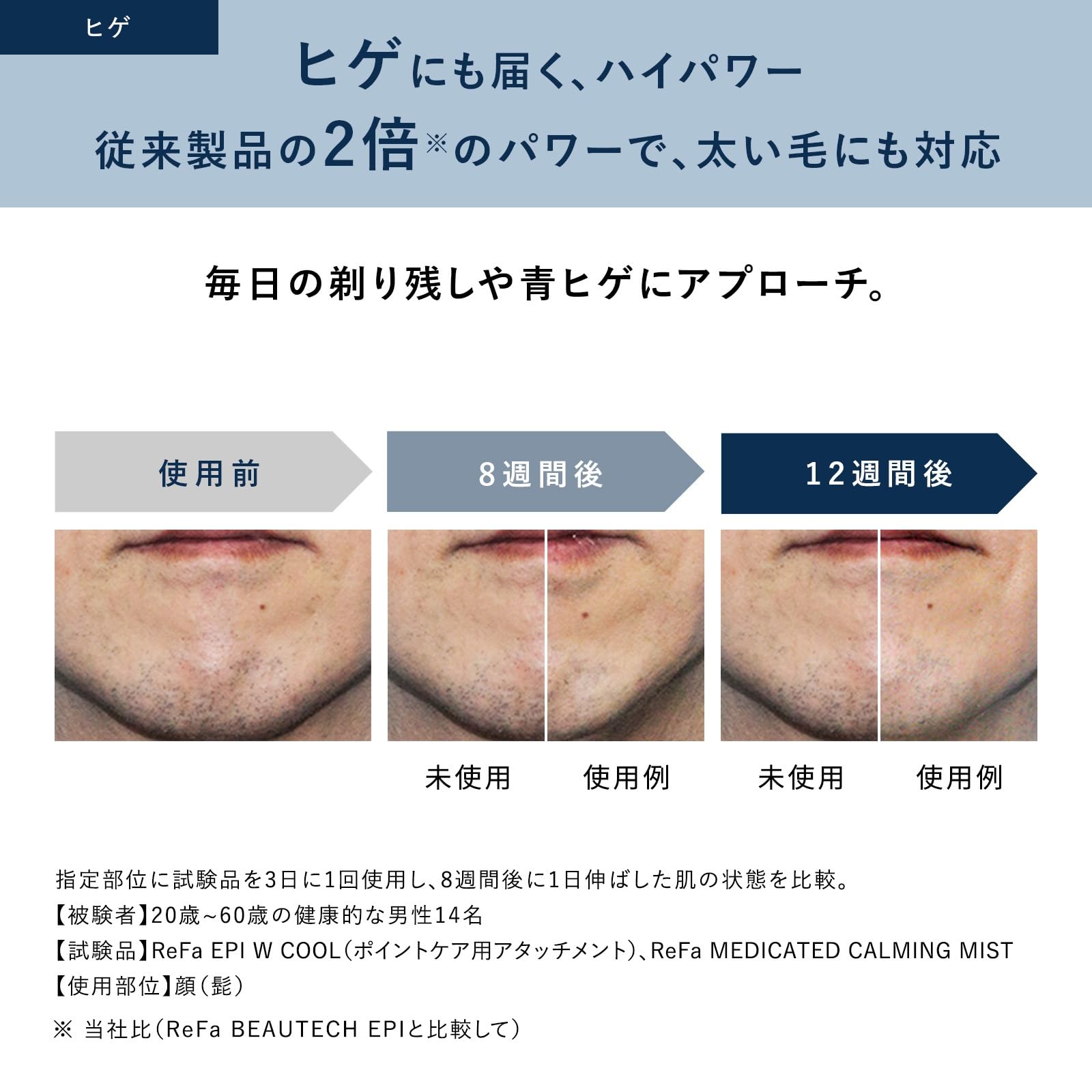 Amazon.co.jp: ◇New Model◇【Official Store Exclusive】ReFa EPI W