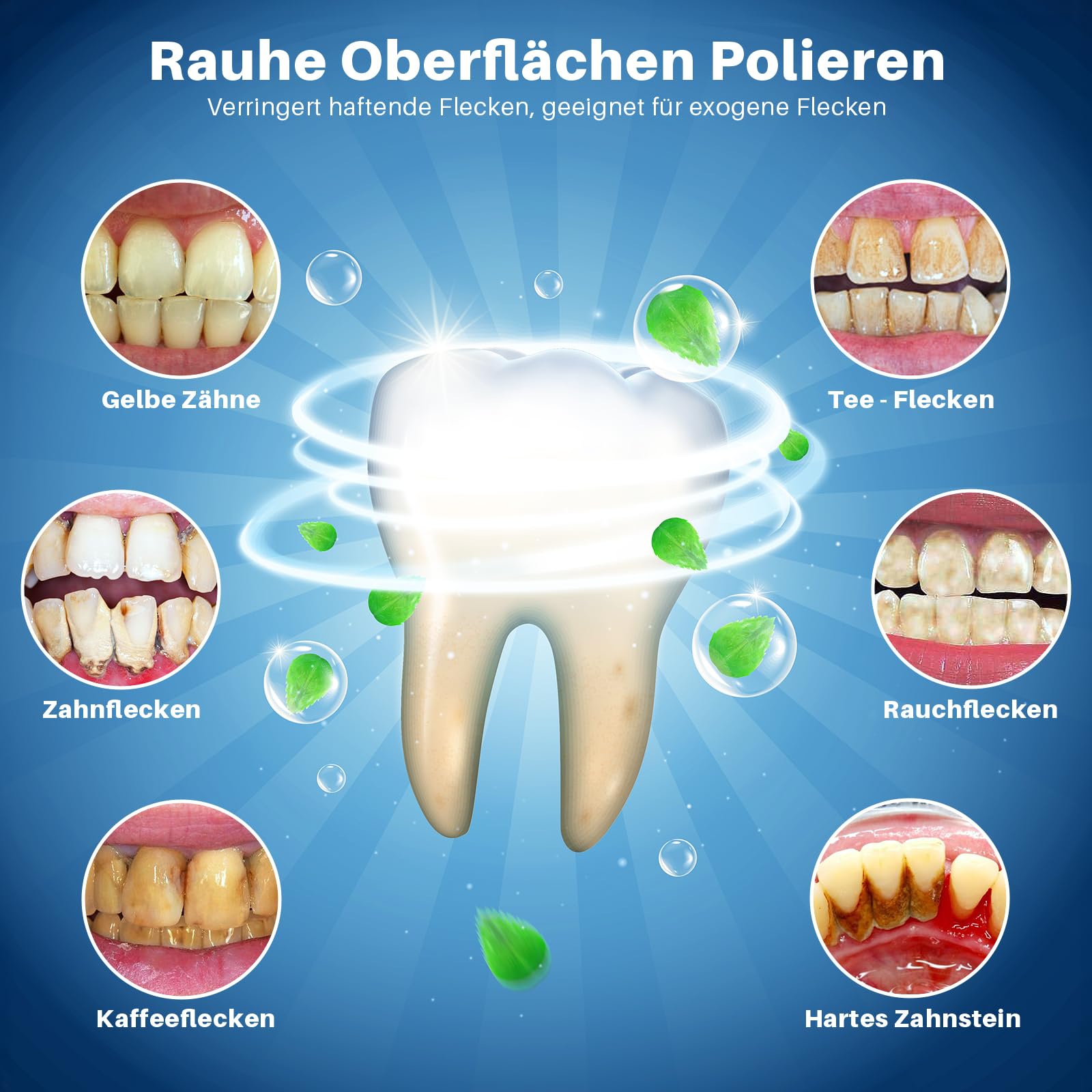 Morfone Set di sbiancamento dei denti, lucidatrice dentale con 5 modalità e 5 teste, set sbiancante per la pulizia dei denti, lucidatura, illuminante, luce LED USB-C IPX6 impermeabile