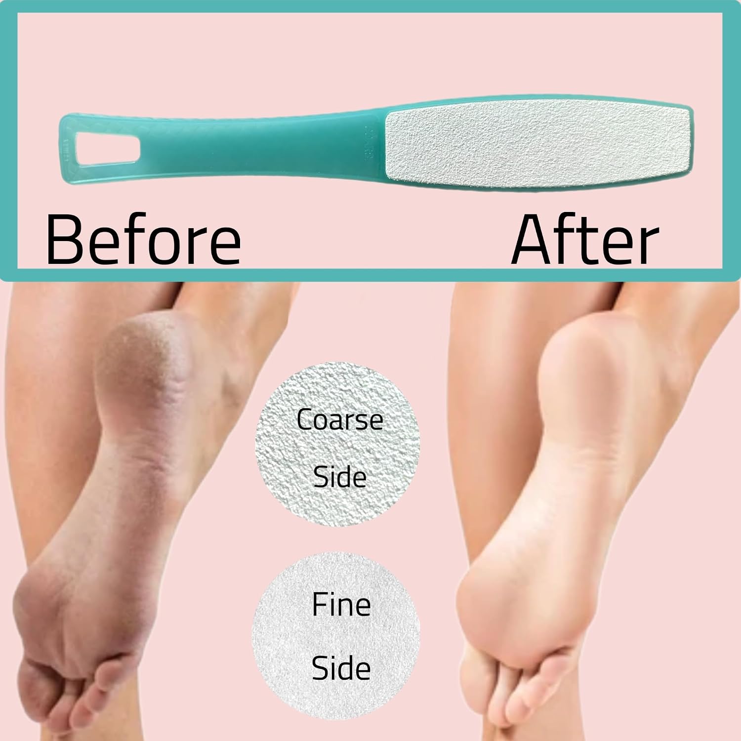 1 ALAZCO Double Sided Foot File Pumice Ergonomic Handle Scrubber Immediate Result Smooth Feet Heel Scraper Exfoliate Buffer Dead Skin Callus Corn Emery Fine & Coarse Pedicure Tool