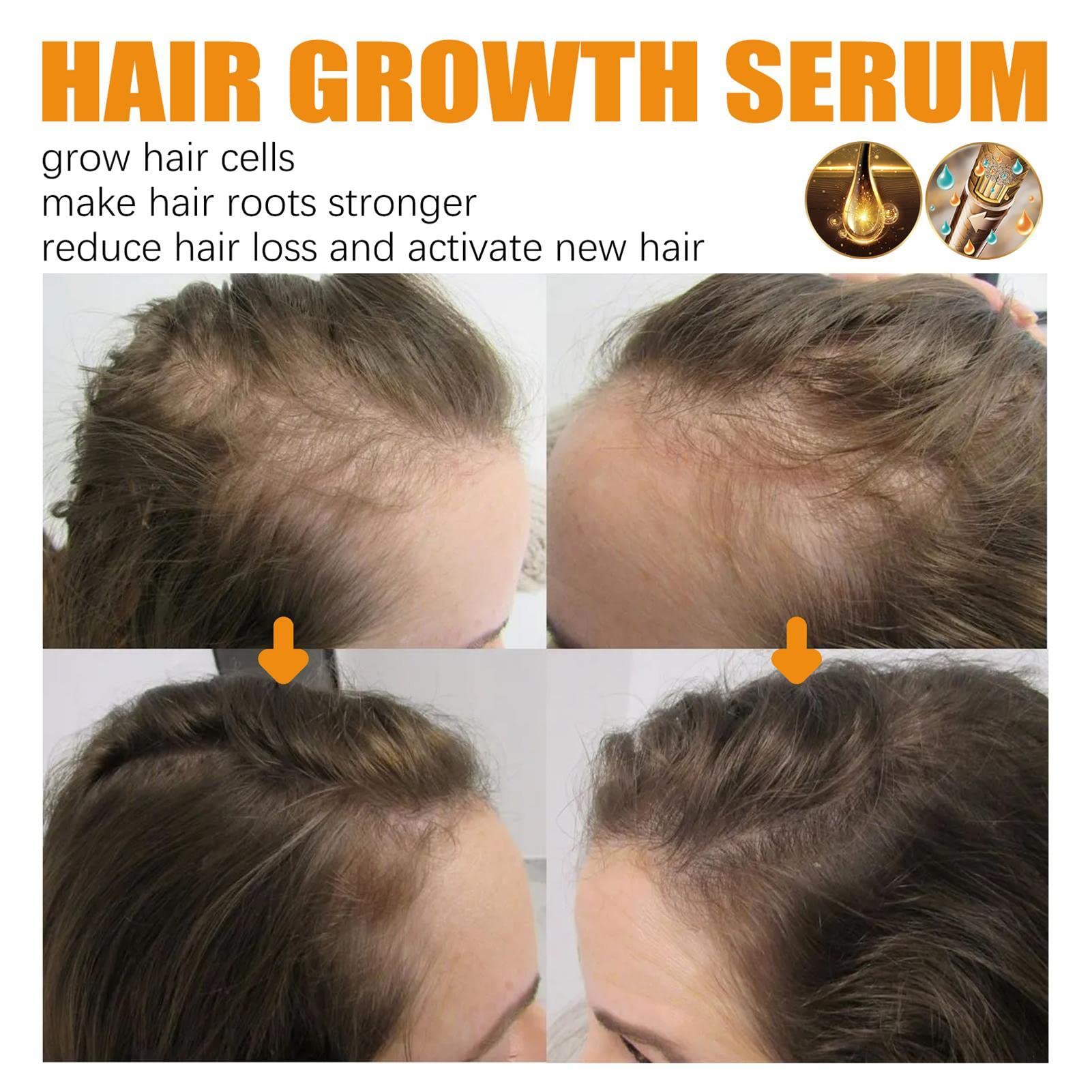 Pro-Growth Biotin Hair Spray, 30 ml, Haar-Loss, Mineral Hairgrowth Spray, Leave In Conditioner, Spray für langes und volleres Haar, Männer, Frauen