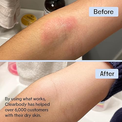 Miniatura 6 de Crema de miel para picor por sequedad, agretamiento e irritación de la piel. Tratamiento de avena de Manuka&Colloidal para dermatitis, herpes