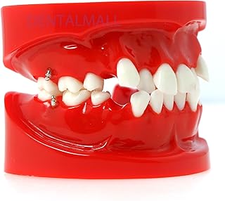 Dentalmall Dental Typodont Teeth Model 1:1 Practice Tooth Model with 4 Mini Bone Pegs Nails Screws for Dental Students,Orthodontist Teaching Explain Learning Props Anisodont Teeth Loss