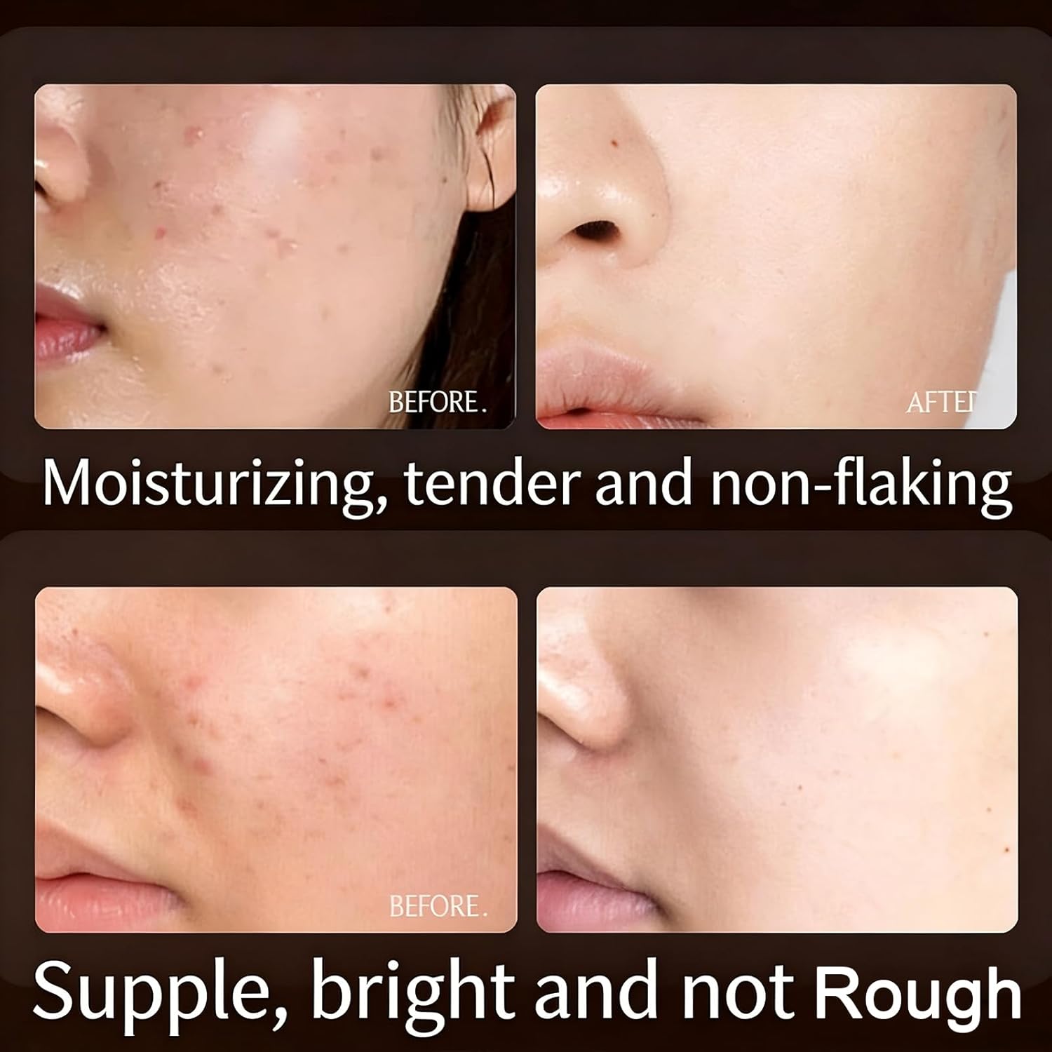 120 Pcs Face Serum Ampoule, Dark Spot Corrector Disposable Daily Facial Serum with Niacinamide, Hyperpigmentation & Melasma Improvement, Hydrating Anti-Aging Serum for All Skin Types