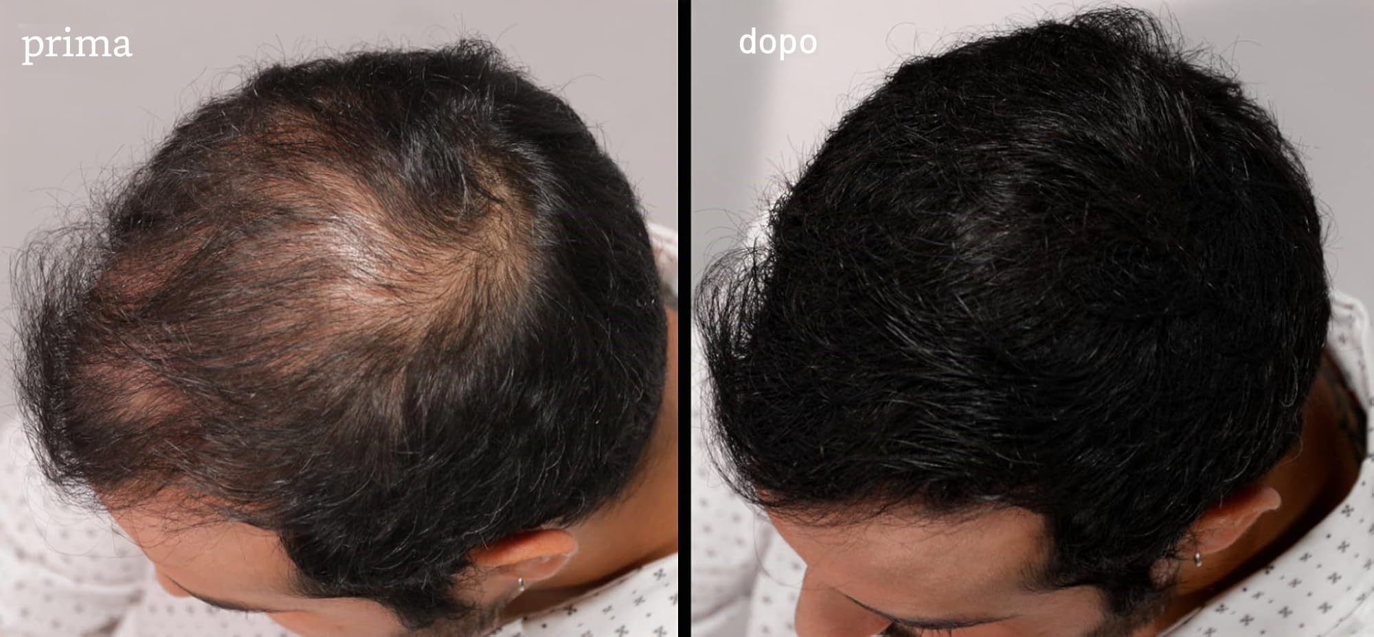 LUXE Fibre ispessimento capelli con cheratina naturale - Dura 2 mesi! - Testato da dermatologi – Ipoallergenico - Molteplici colori disponibili. Castano scuro