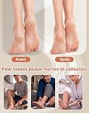 Rapeuse Pieds électrique avec 60 Disques Abrasifs et Vitesse Variable Anti-callosité Lime Pieds Electrique Râpe à Pied Pédicure Honeyglow Élimine Callosités Et Peau Morte À La Maison - Doré champagne - 6