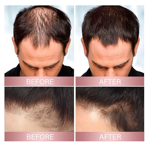 2Pc Rice Water Hair Growth Helper Spray for Thinning Hair, Unscented Oil for All Hair Types, Fast Absorption Hair Thickening Natural Spray(50ml)