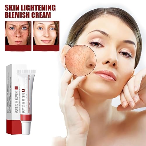 Miniatura 2 de Crema para Manchas Oscuras en La Cara, Cremas para Quitar Manchas de La Cara, Crema Blanqueadora para Pecas, Elimina el Melasma Manchas Oscuras