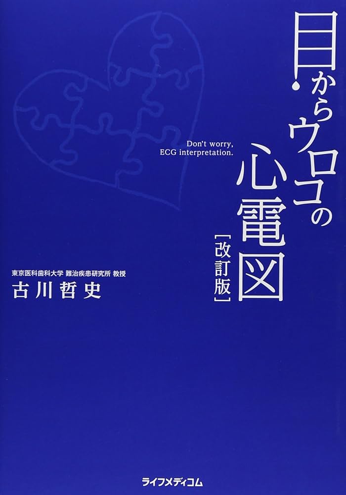 目からウロコの心電図 | 古川 哲史 |本 | 通販 | Amazon