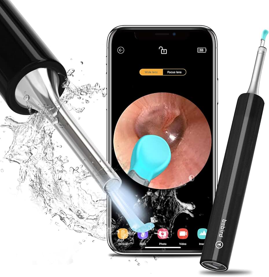 Amazon.ca ear cleaning camera