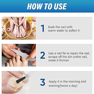 Advanced Nail Formula for Toenail and Fingernail - Nourishing and Strengthening Solution to Improve Damaged Nails