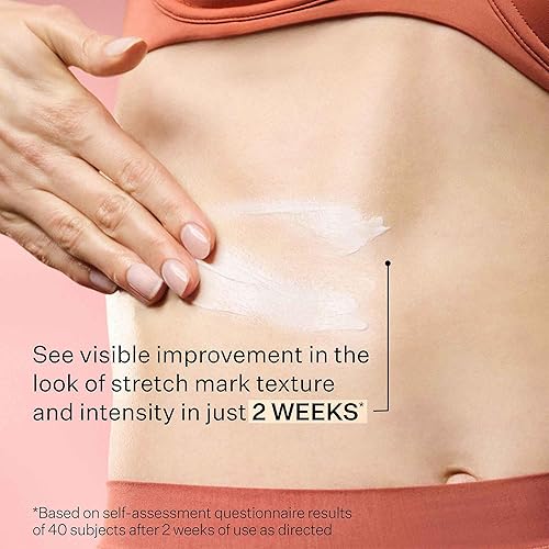 Miniatura 8 de StriVectin SD Advanced Plus - Hidratante intensivo para arrugas y estrías, para rostro y cuerpo, estimulante de colágeno con péptidos y ácido