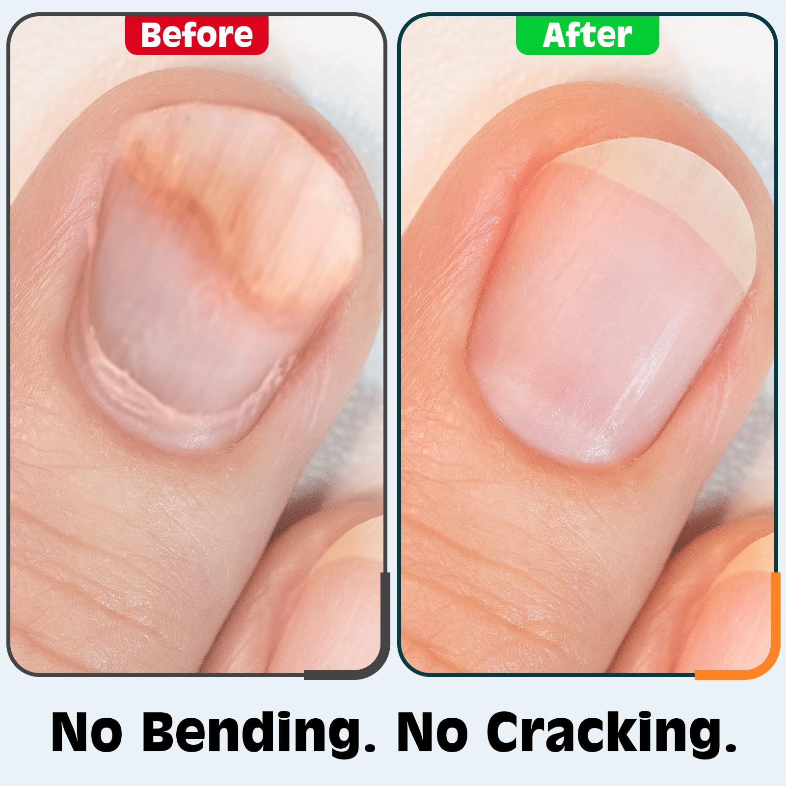 Verbessertes 20 % ultra-schärferes Nagelknipser-Set, 15 % dicker, stabiler Edelstahl, 3-in-1 Fingernagel-/Zehennagel-/Schrägknipser, Geschenke, Reise-Nagel-Set für Männer und Frauen, Schwarz