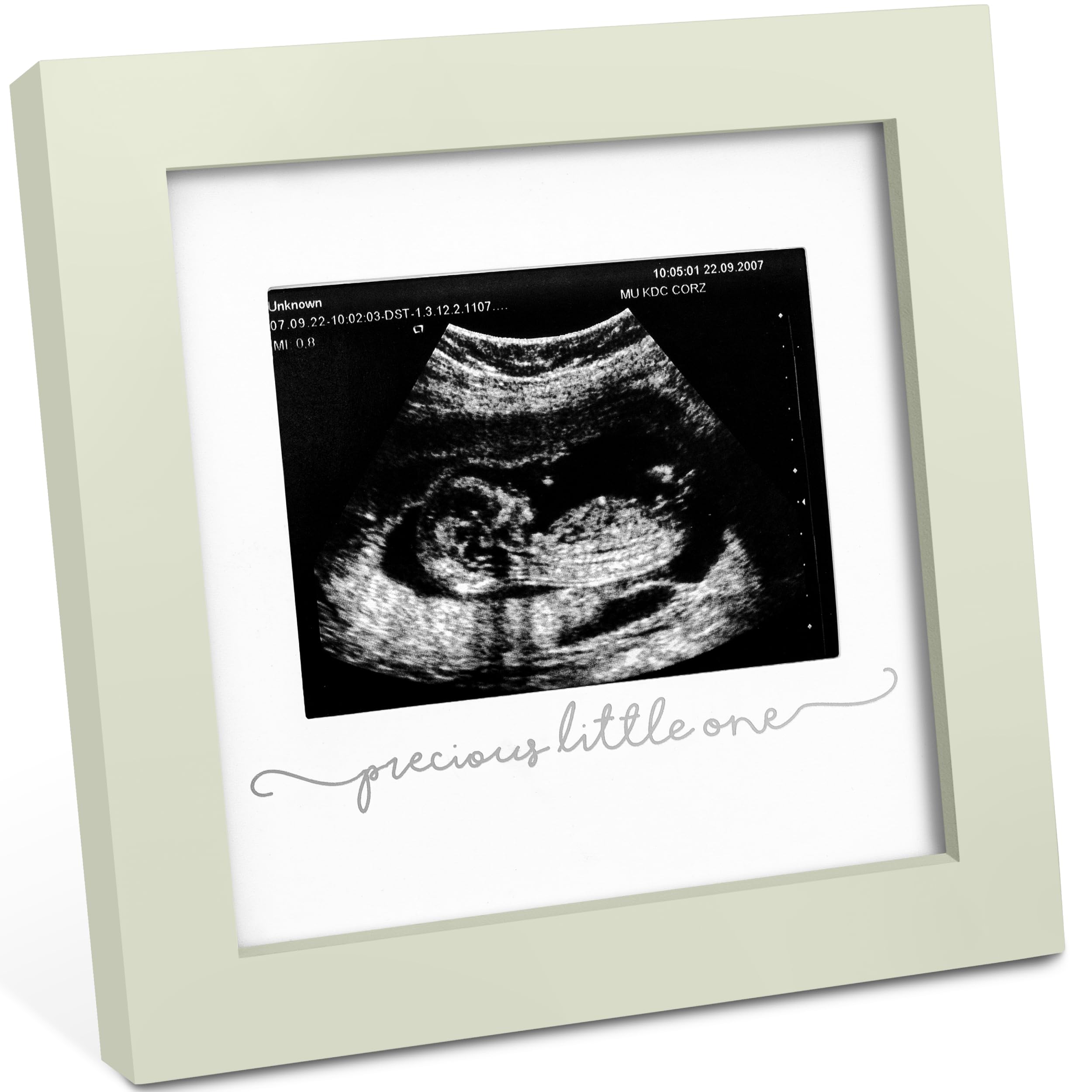KeaBabies Baby Sonogram Picture Frame - Modern Ultrasound Picture Frames for Mom to Be, First Pregnancy Gifts for Expecting Mom & First Time Dad, Baby