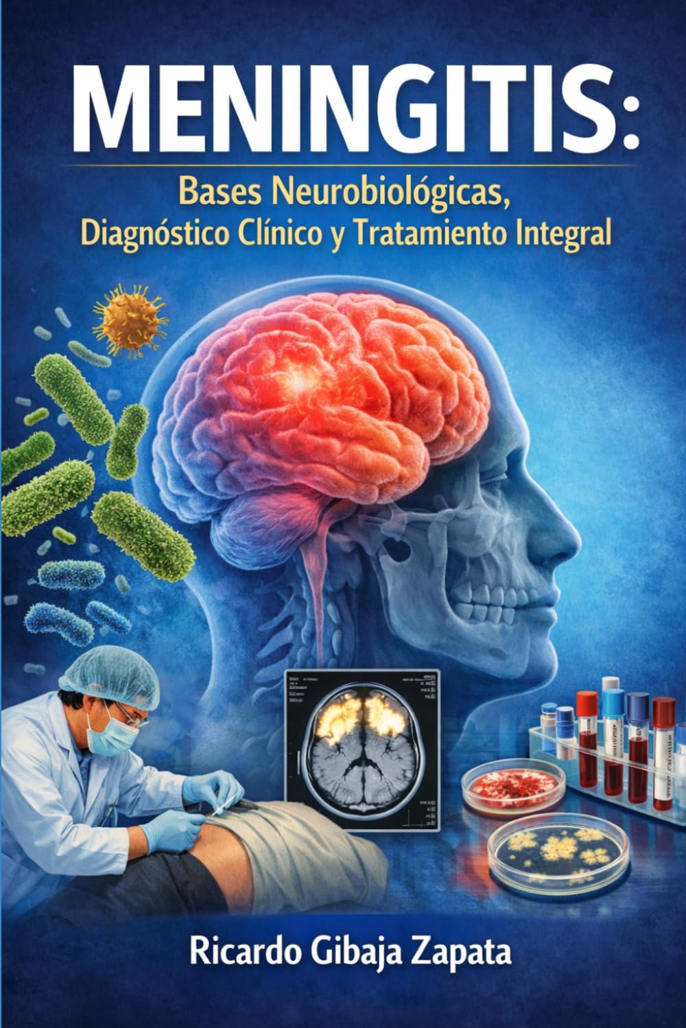 Meningitis Bases Neurobiológicas, Diagnóstico Clínico y Tratamiento Integral
