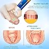 BruteCo Phimosis Correction Gel for Foreskin Narrowing Correction Gel for Excess Foreskin Natural Ingredients Phimosis Foreskin Correction Gel Quick and Gentle Effective Relief