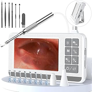 Ohrenschmalz Entferner Otoskop, VITCOCO 3,9mm Otoskop Mit 4.3-Zoll HD IPS- Bildschirm, Ohrenreiniger Ultradünne, Ohrreiniger mit Kamera, Weiß
