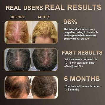 Laser Hair Growth Comb