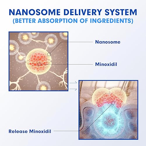 Miniatura 4 de 5% de minoxidil para hombres tratamiento de crecimiento del cabello, solución tópica extra fuerte para adelgazamiento del cabello y calvicie,