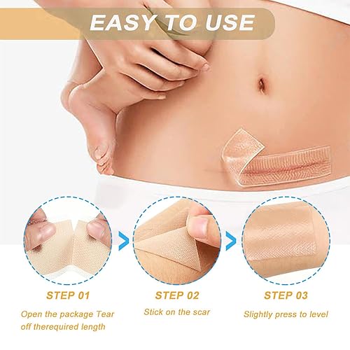 Miniatura 2 de Hojas de silicona para cicatrices, cinta de silicona de grado médico, hojas profesionales para eliminar cicatrices, cuidado quirúrgico de la piel