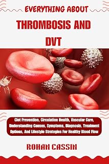 EVERYTHING ABOUT THROMBOSIS AND DVT: Clot Prevention, Circulation Health, Vascular Care, Understanding Causes, Symptoms, Diagnosis, Treatment Options, And Lifestyle Strategies For Healthy Blood Flow