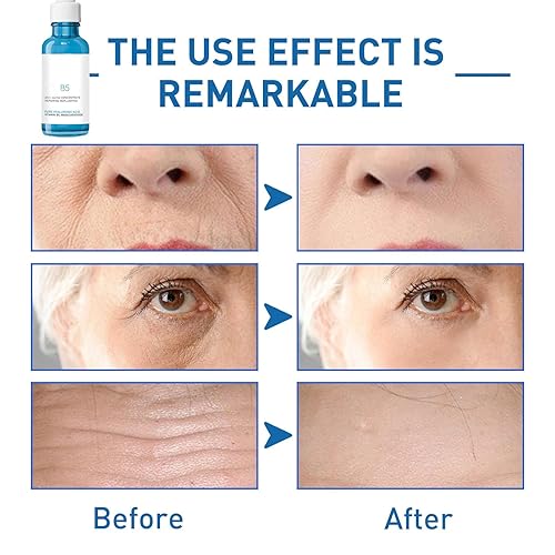 Miniatura 4 de Hyalu B5 Suero, suero facial Botox, suero de ácido hialurónico para cara con vitamina B5, ajuste facial instantáneo para líneas finas de
