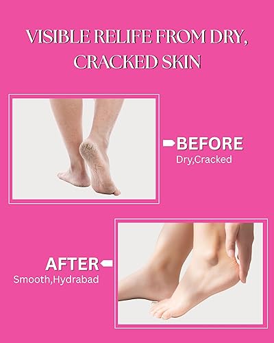 Miniatura 7 de DT Crema de colágeno para manos y pies, hidratación intensiva con urea y colágeno, 4 onzas, sin parabenos