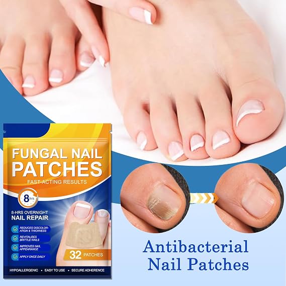 32PCS Extra Strength Fungal Nail Patches for Toenail Fungus – Deep Penetration Overnight Repair – Gentle & Hypoallergenic Formula