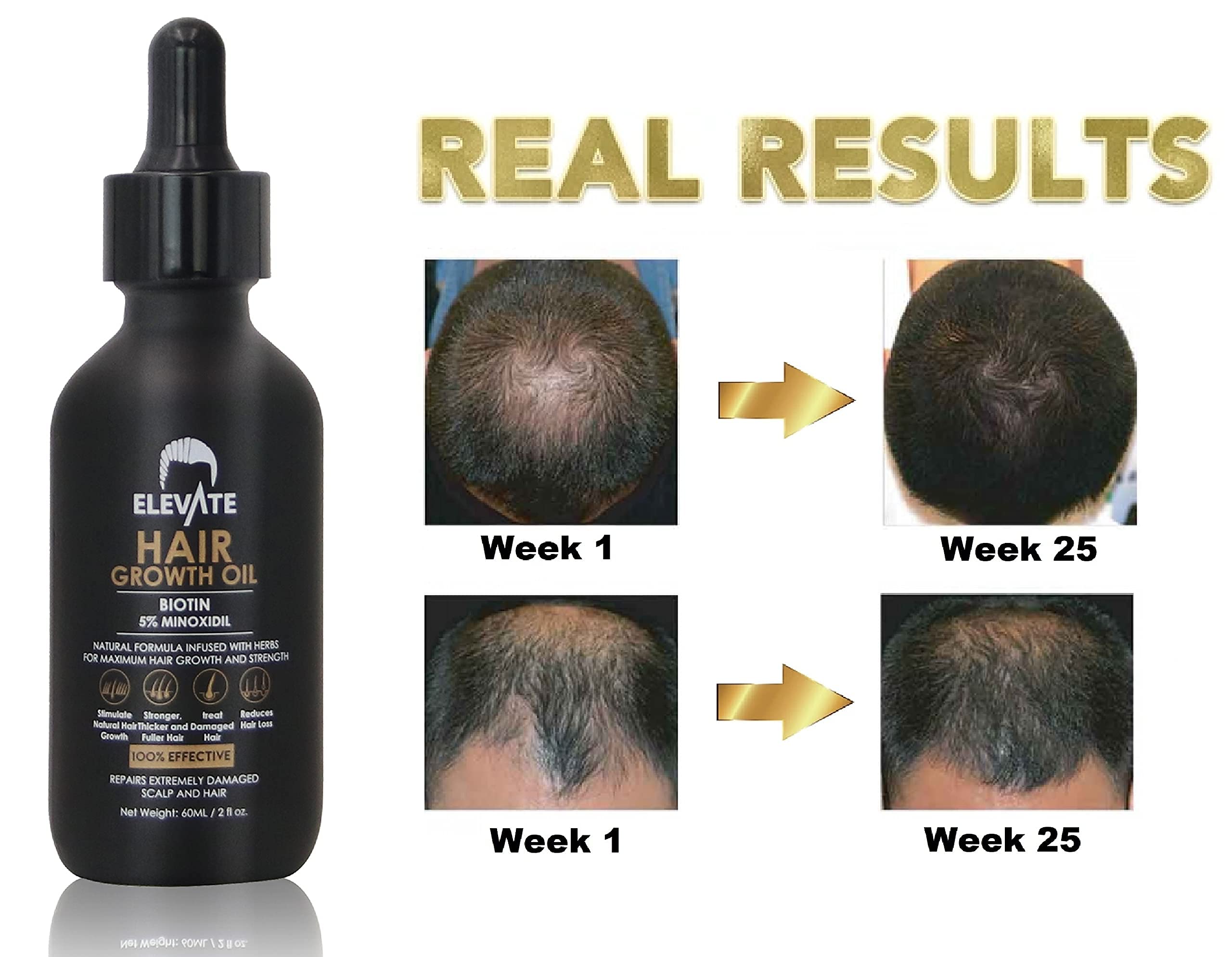 ELEVATE Hair Growth Oil Biotin Hair Growth Serum & 5 Minoxidil
