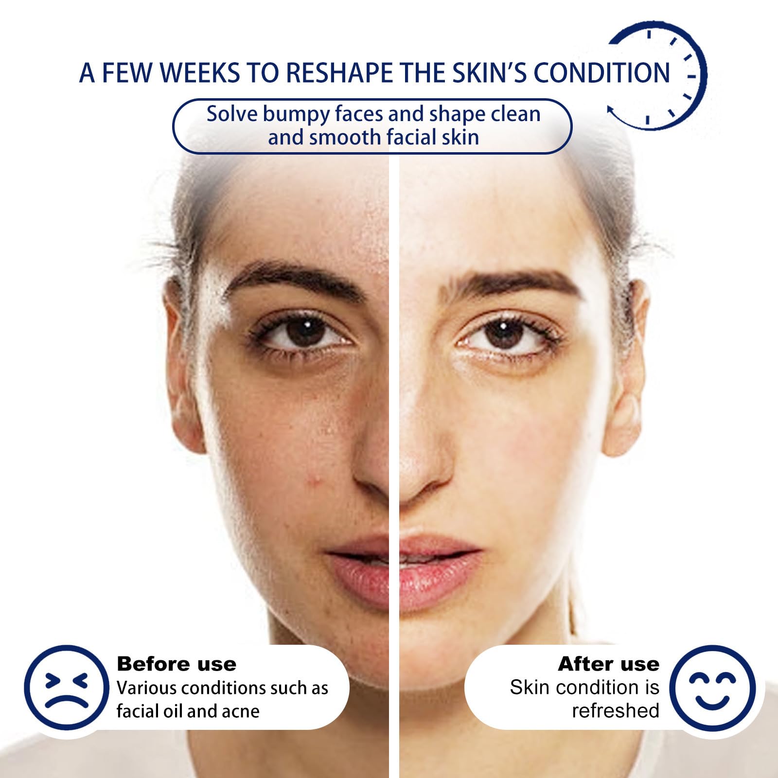 Acne Foaming Wash pianka do mycia trądziku, pianka do oczyszczania twarzy, kojąca pianka do codziennego czyszczenia skóry twarzy