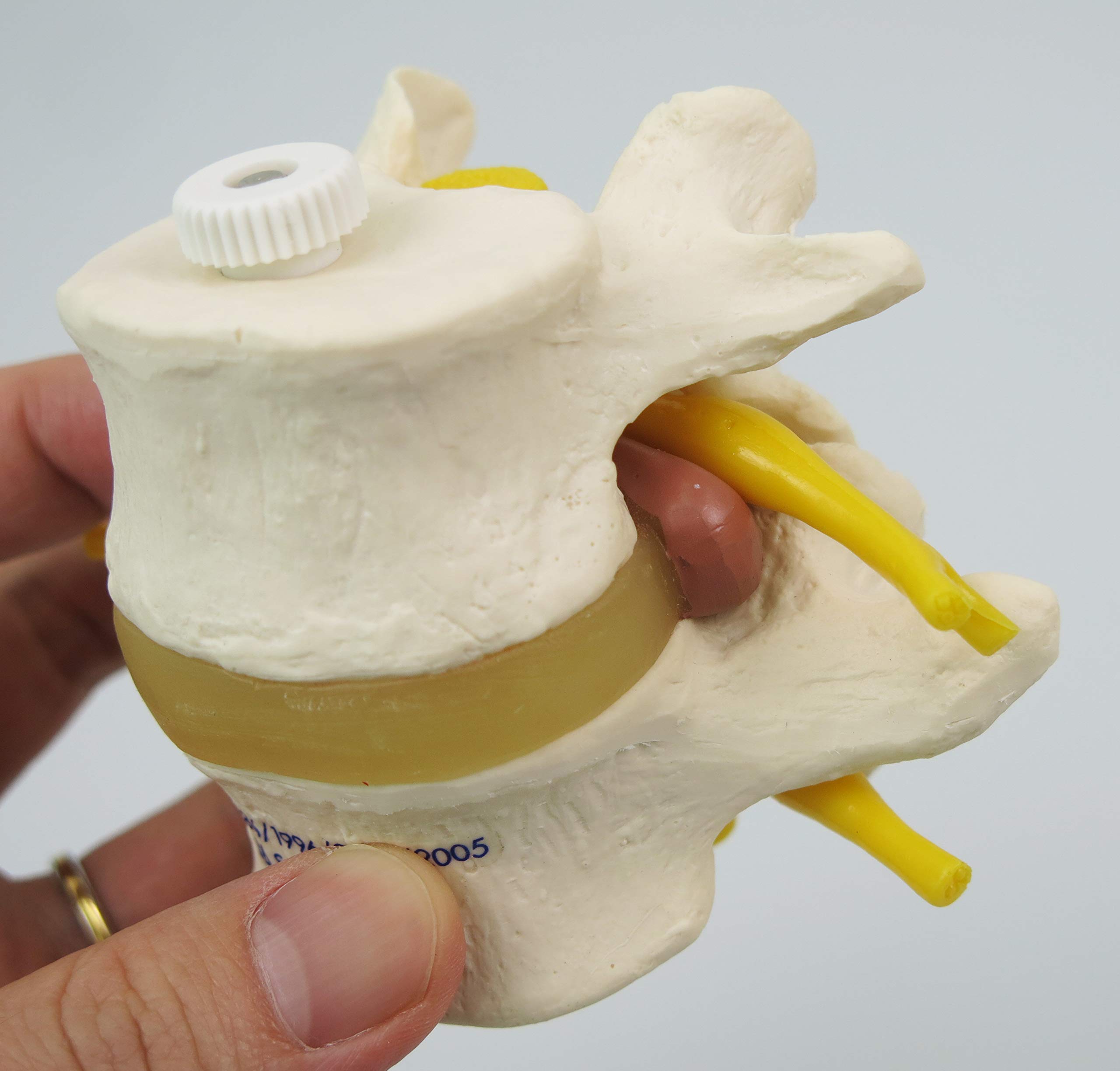 3B Scientific® 2 Vertèbres Lombaires avec Hernie Discale – Modèles Anatomiques Montés de Manière Flexible + Smart Anatomy App (Garantie de 5 Ans)
