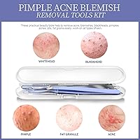 Vista 7 de Teenitor 7 Pcs Pimple Popper Tool Kit, Surgical Grade Blackhead Remover Tools, Ingrown Hair Tweezers, Blackhead Extractor Pimple Extractor, Black