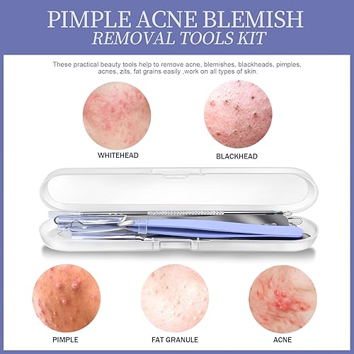 Miniatura 7 de Teenitor Kit de herramientas para reventar espinillas, herramientas de eliminación de puntos negros de grado quirúrgico, pinzas para el cabello