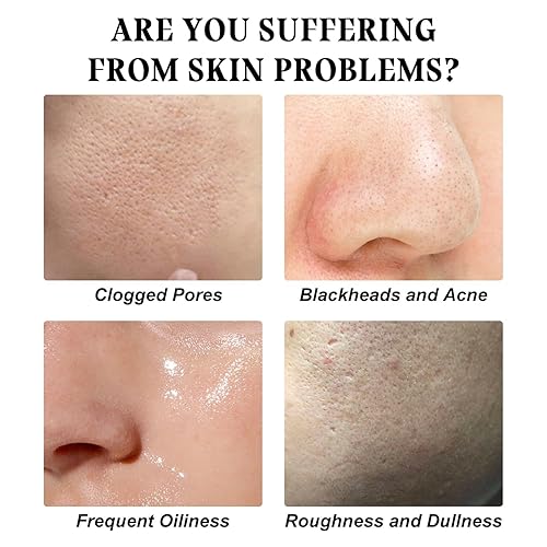 Miniatura 6 de Máscara de oro despegable, 98.4% de oro, máscara facial de oro de 24 quilates, máscara removedor de puntos negros, máscara facial dorada para