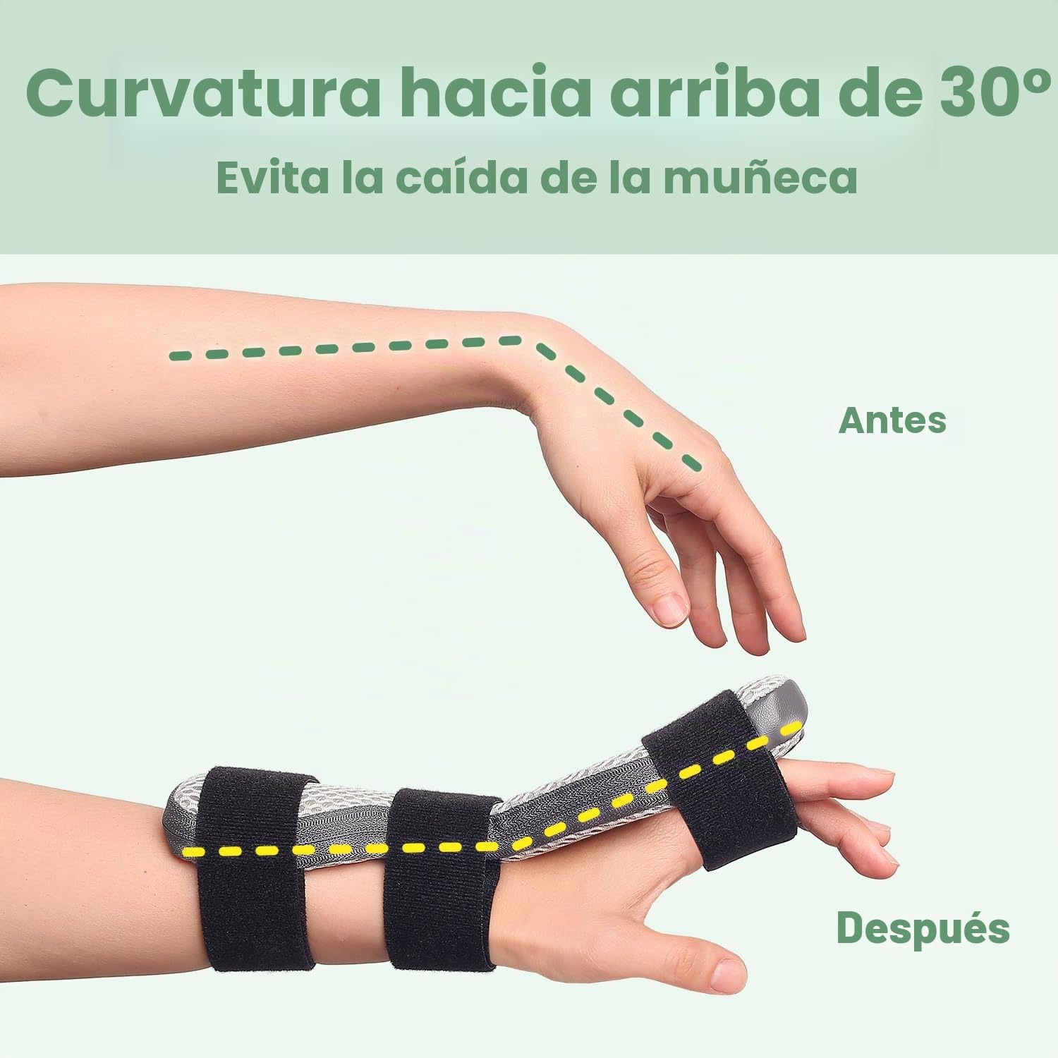 DrFinger Férula de Mano para Nervio Radial para Caída de Muñeca, Ajustable Fijación de Dedos Estabilizador, para Parálisis de Muleta, Cojear los Dedos, Artroplastia MCP - Manos Izquierda & Derecha