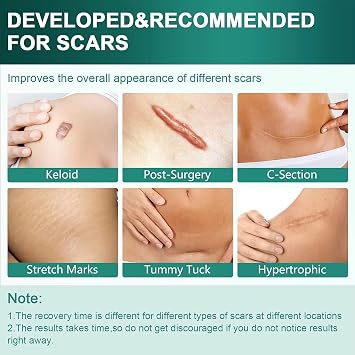 Lejuv Silicone Patches, Reusable Medical-Grade Lejuv Silicone Face Tape, 1.6in X 4.7ft Lejuv Overnight Beauty Patches for Forehead, Eyes, Mouth, Neck, Cut to Fit (1PCS)