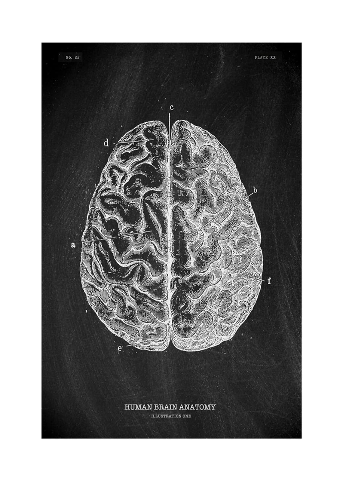 Anatomía humana Marca de arte Medical Hospital hospital Sistema órgano muscular Vintage lienzo(KK1408,70x110cm No Frame)