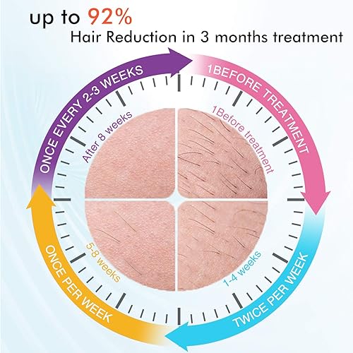 Miniatura 2 de IMENE Máquina de depilación permanente para mujeres y hombres, sistema IPL de 500,000 destellos con función de cuidado del hielo para uso doméstico