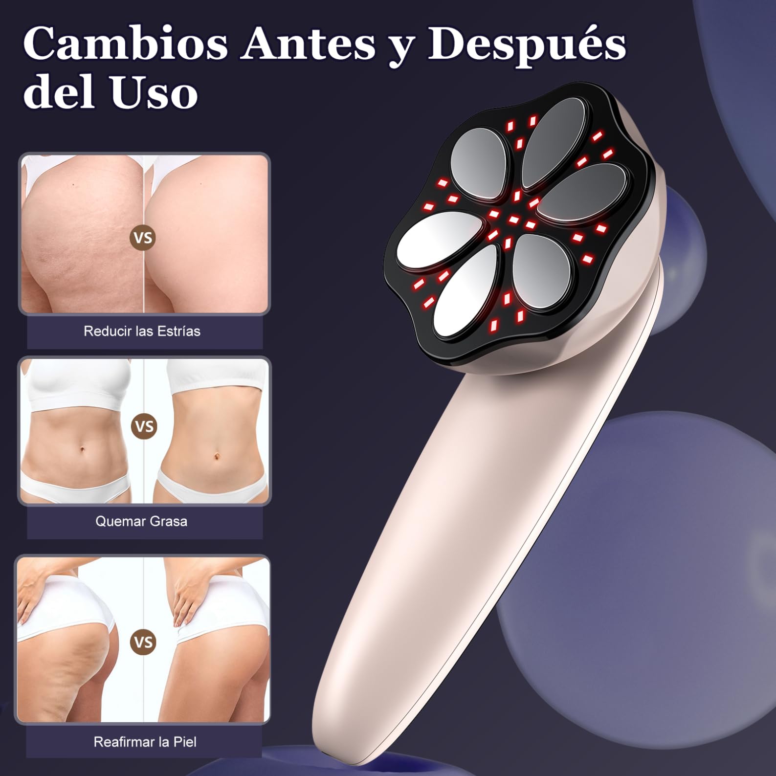 Masaje Anti Celulitis Masajeador, Aparato Anti Celulitis, 3 en 1 Masajeador Anticelulítico Multifuncionales Portátiles Para el Tamaño, Vientre, Nalgas, Brazosy Piernas, Unise, Hombres para Levantar — view 6