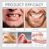 False Teeth Set Full Dentures,Silicone Denture Reline Kit,Soft Silicone Reline Denture Set,False Te/eth Set with Clip In Veneers,Snap On Dentures,False Teeth Veneers Top and Bottom,Clip On Vene/ers