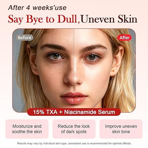 Miniatura 2 de Suero de niacinamida 10% + TXA 5% ácido para la cara, suero de manchas oscuras para tono de piel desigual y cuidado de hidratación, sin fragancia,