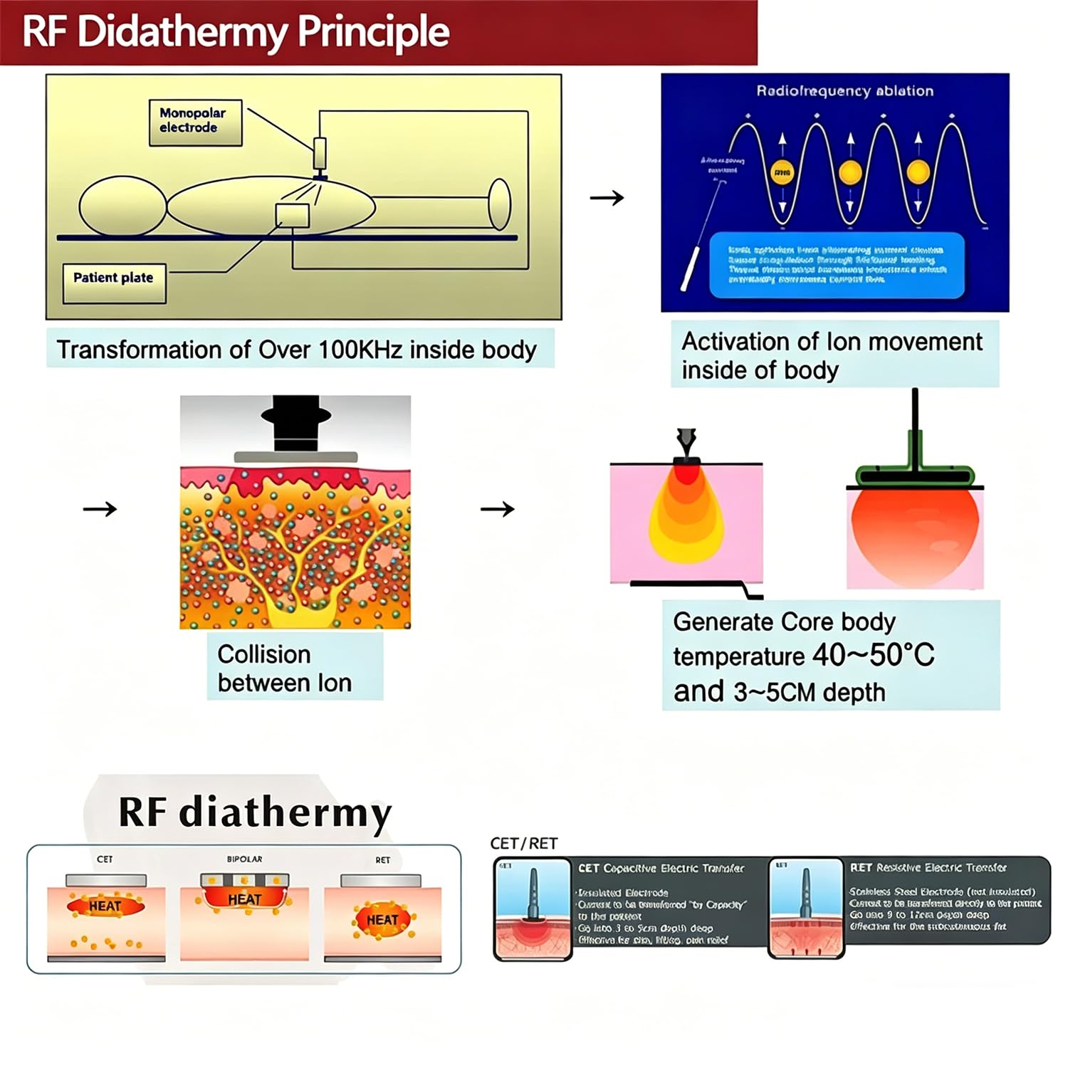 448khz Indiba RET CET Tecar Therapy Rf Tecar Macchina per terapia di sollievo profondo dal dolore Radiofrequenza Fisioterapia Ablazione Perdita di peso Macchina a trasferimento elettrico capacitivo RF