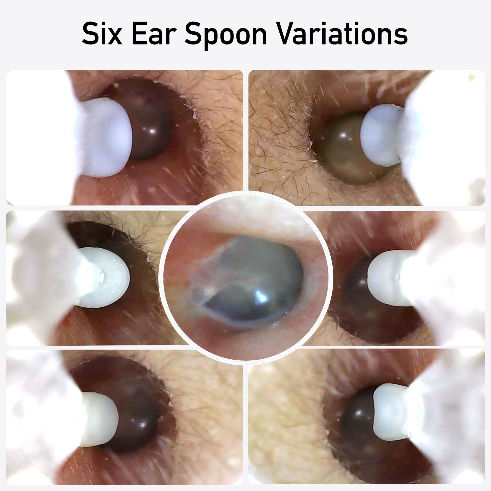 OXORA EarScope – Ear Cleaner – Ear Wax Removal Tool Camera – Earwax Remover Kit – Wireless Otoscope with LED Light – Ear Care Cleaning Products – iPhone and Android – Gift for Adults Kids Babies…