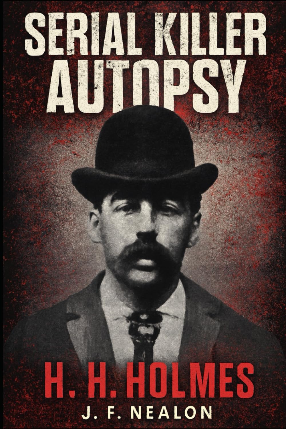 Serial Killer Autopsy: H. H. Holmes