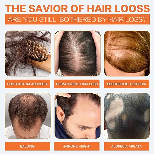 Miniatura 2 de Suero de crecimiento del cabello para mujeres negras con Chebe, suero de crecimiento del cabello de belleza, forma de producto natural para