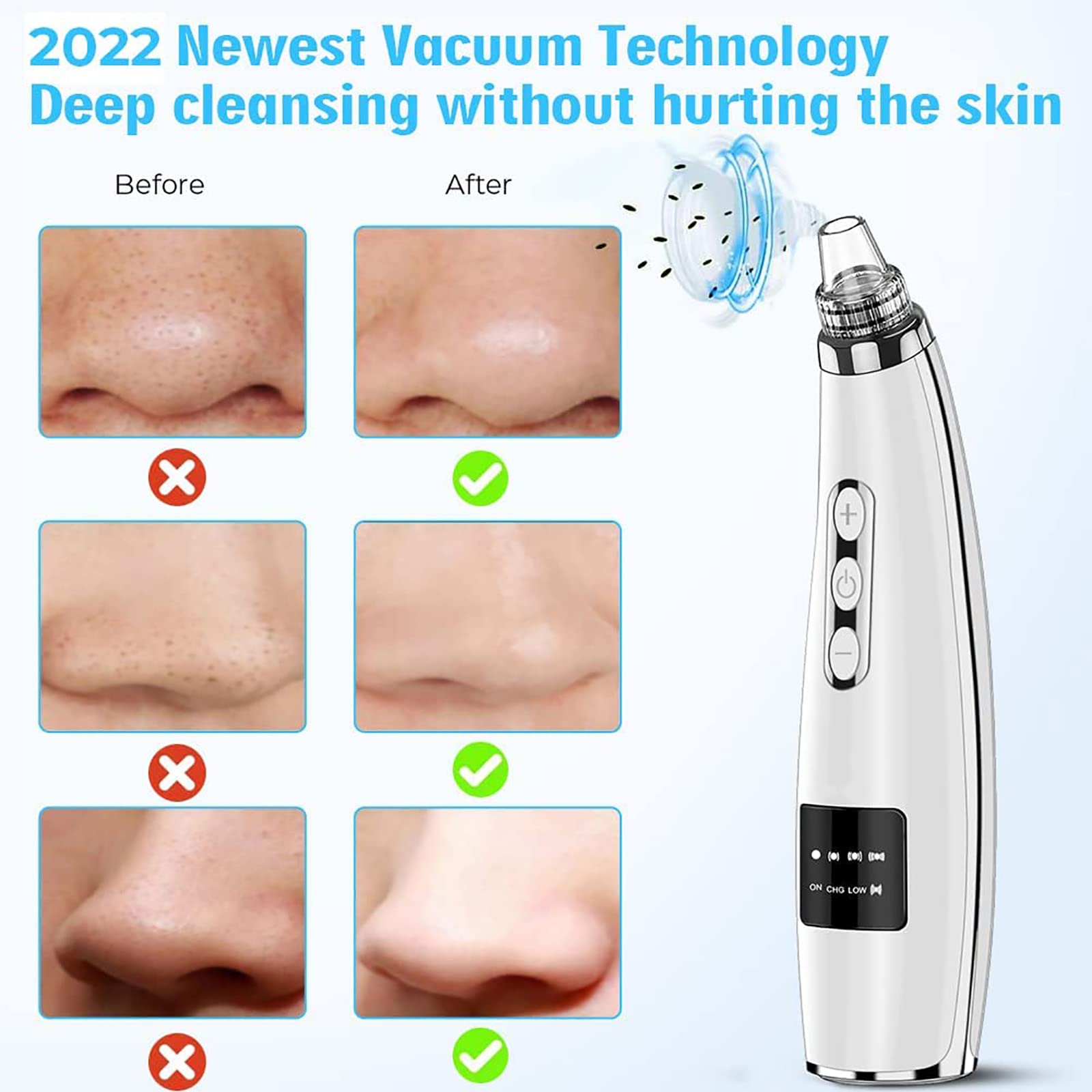 Aspirador de poros para eliminar puntos negros, limpiador de poros faciales, herramienta extractora de puntos blancos de comedones de acné, limpiador eléctrico de poros de aspiradora facial,