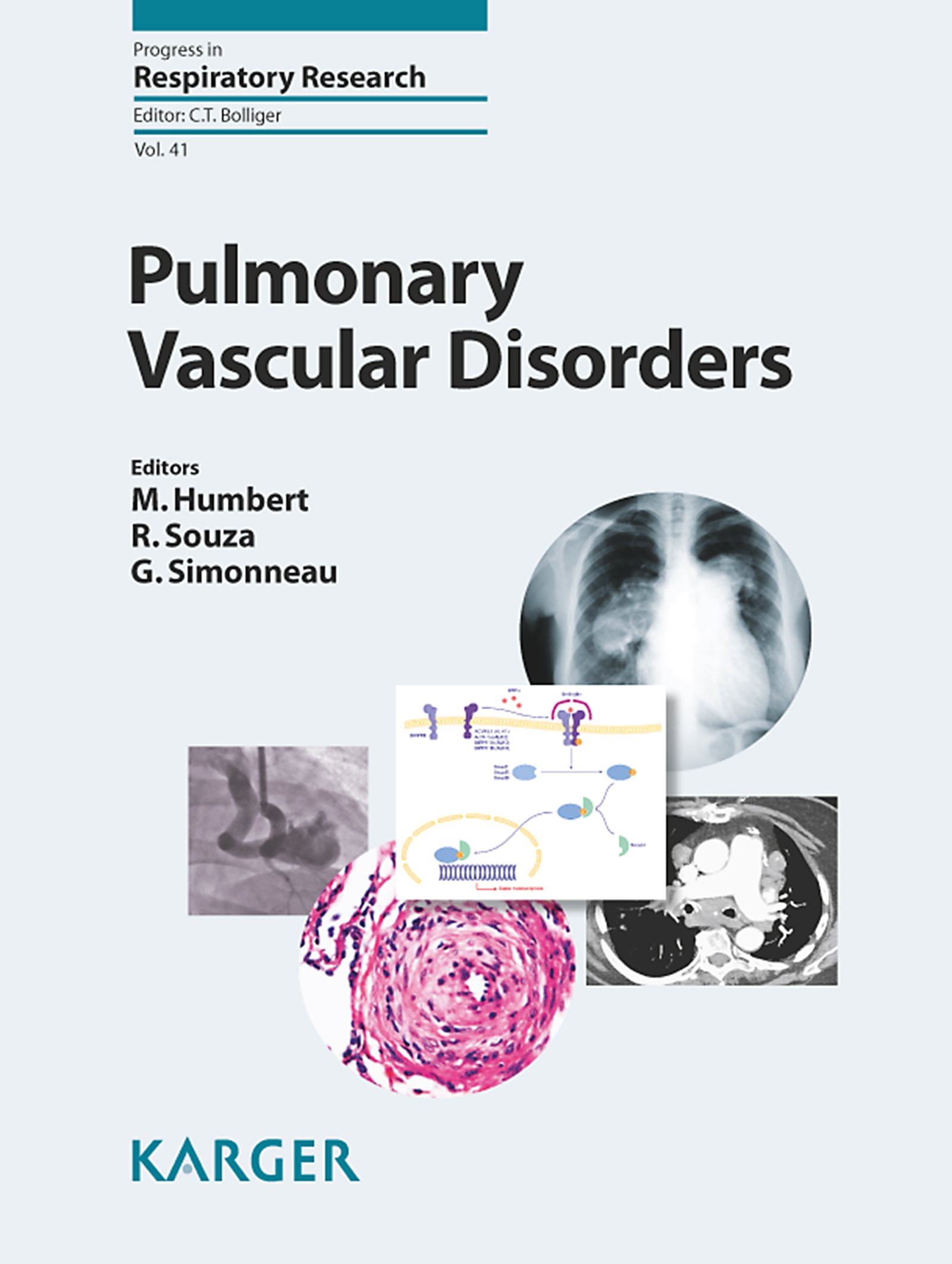 Pulmonary Vascular Disorders (Progress in Respiratory Research)