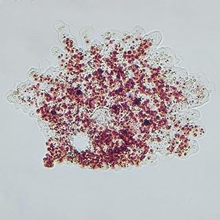 Amoeba Proteus, Living, Vitachrome