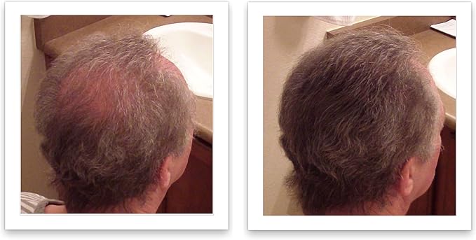 Caboki Hair Fibres 25g Medium Brown